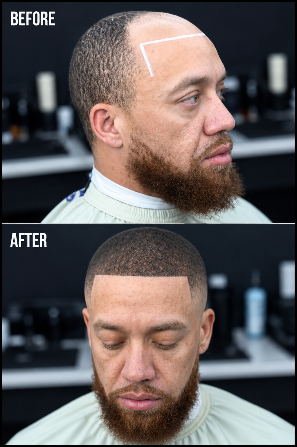 Hair fibre product worked into a thinning front, then the hairline shaped with a trimmer and carried back into the temples.